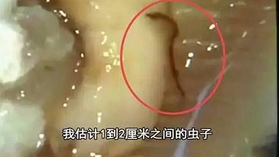一只生蠔引起的冤案，觸動了餐飲人的“麻木神經(jīng)”
